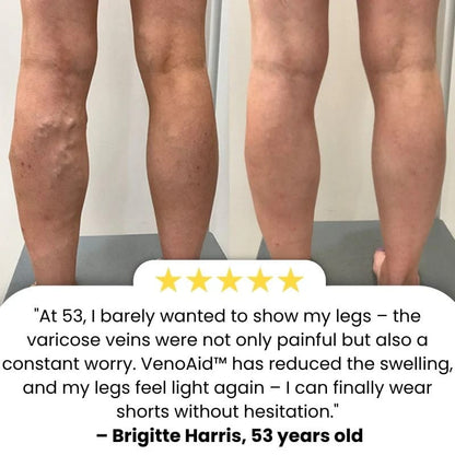 BioEquis Varicose Vein Relief Spray