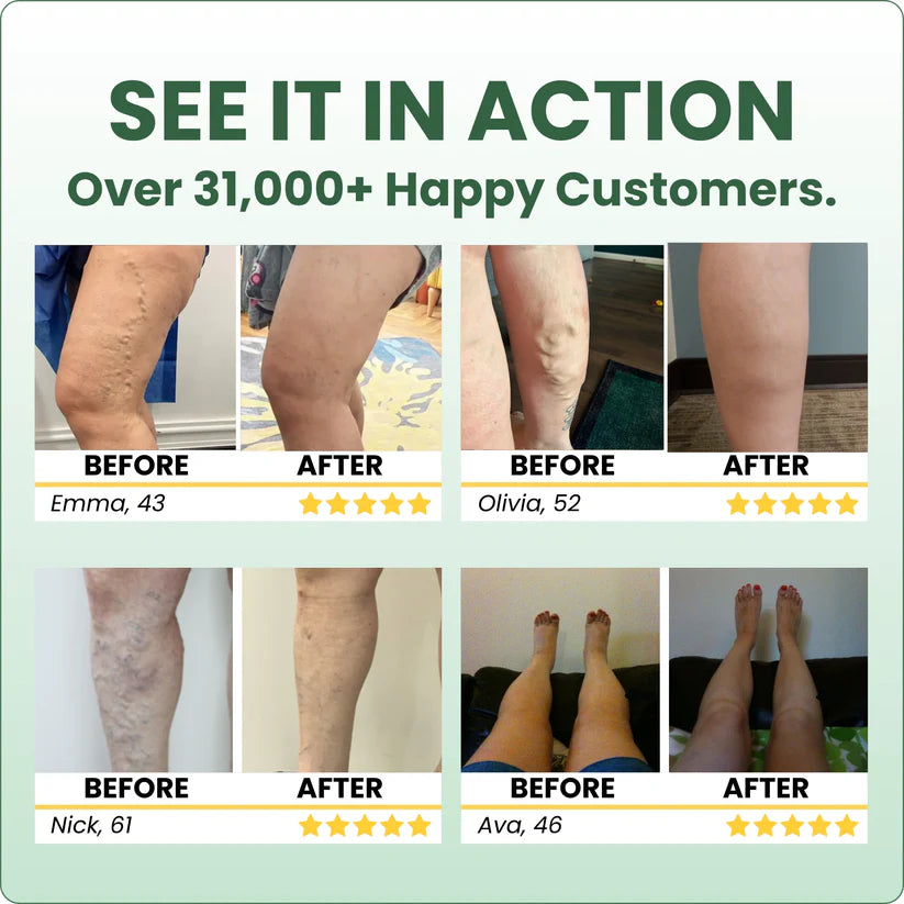 The Senzio Miracle Balm™ Herbal Powerhouse