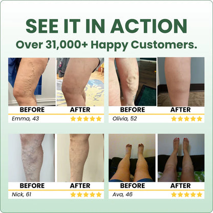 The Senzio Miracle Balm™ Herbal Powerhouse