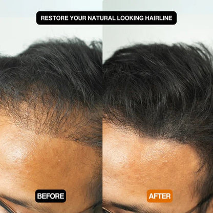 HairBear Filler Powder - BEST MURAH