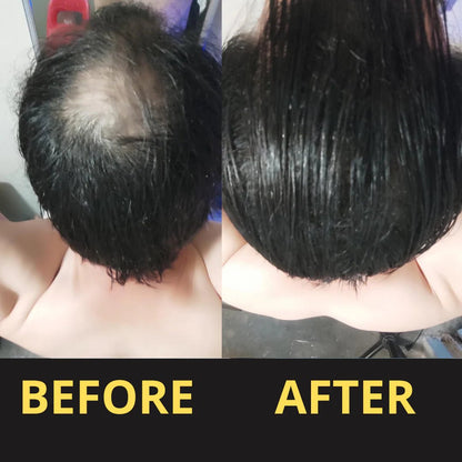HAIRFILLUP HAIR CONCEALER 50ML - (BLACK/BROWN) - BEST MURAH