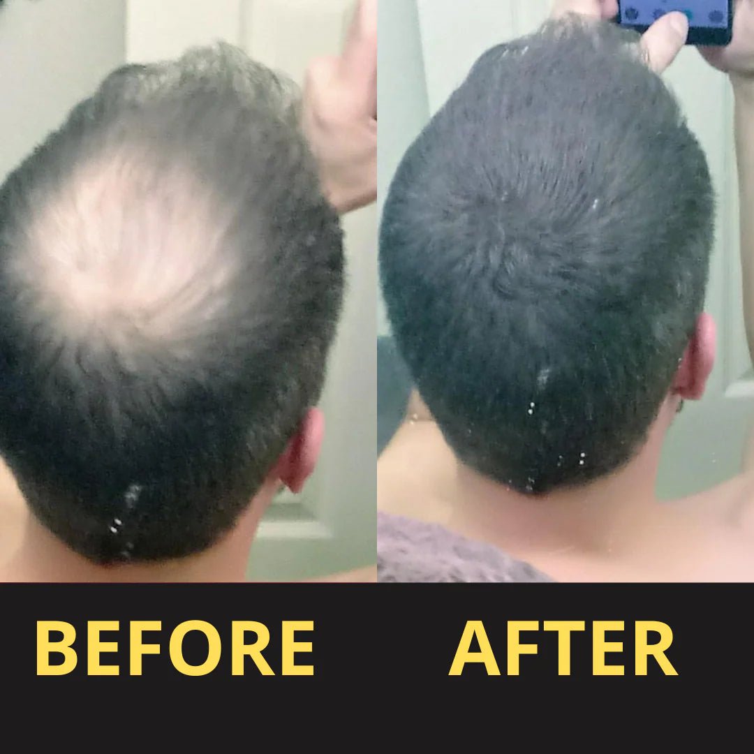 HAIRFILLUP HAIR CONCEALER 50ML - (BLACK/BROWN) - BEST MURAH