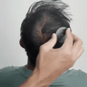 Apply to target areas