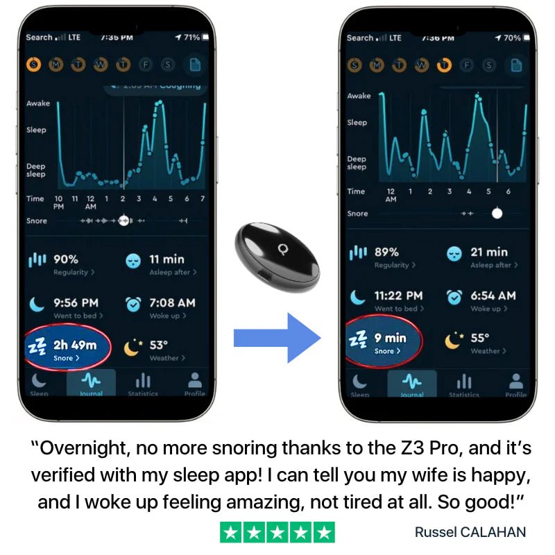 Z3 Pro Smart EMS Sleep Device - BEST MURAH