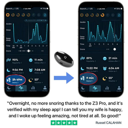 Z3 Pro Smart EMS Sleep Device - BEST MURAH